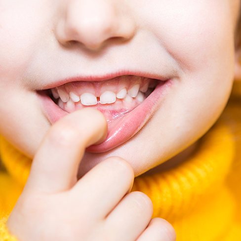 Small child showing their primary teeth